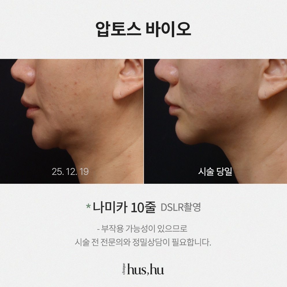 본문 내용을 보조하는 이미지