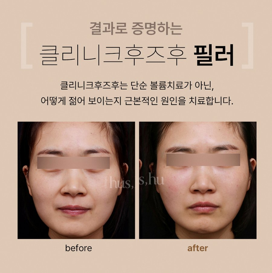 본문 내용을 보조하는 이미지