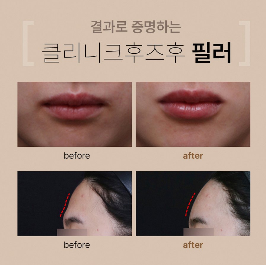 본문 내용을 보조하는 이미지