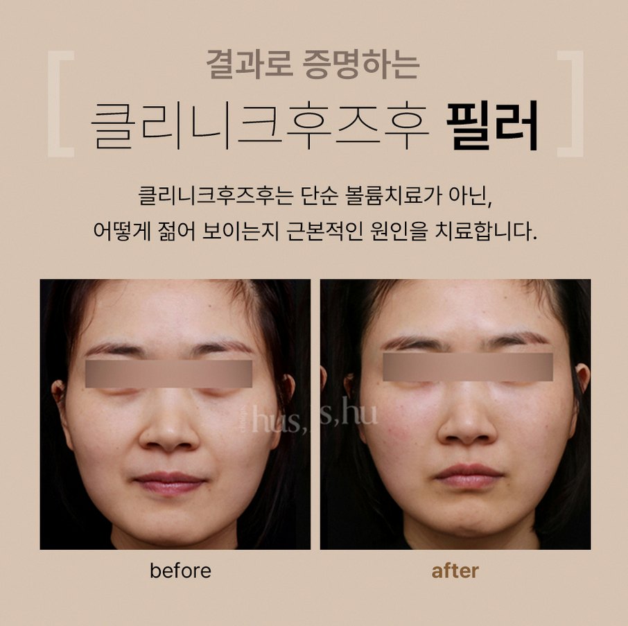 본문 내용을 보조하는 이미지