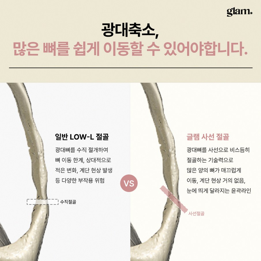 본문 내용을 보조하는 이미지