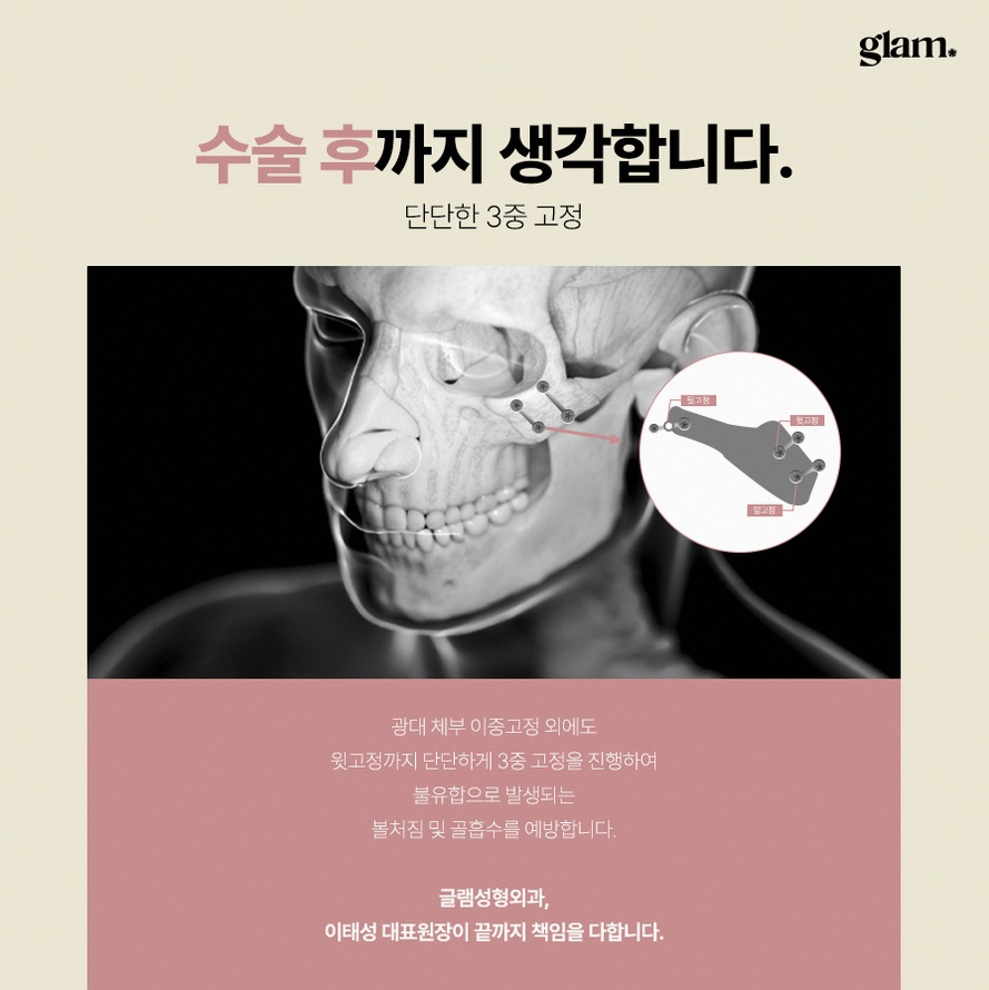 본문 내용을 보조하는 이미지