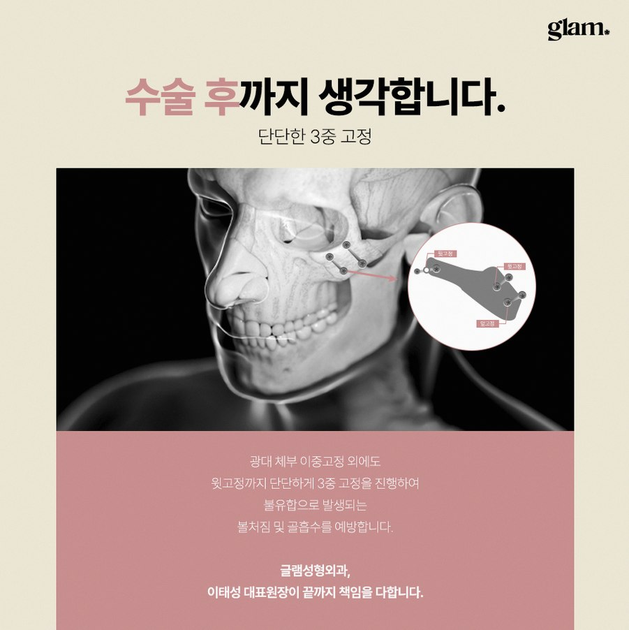 본문 내용을 보조하는 이미지