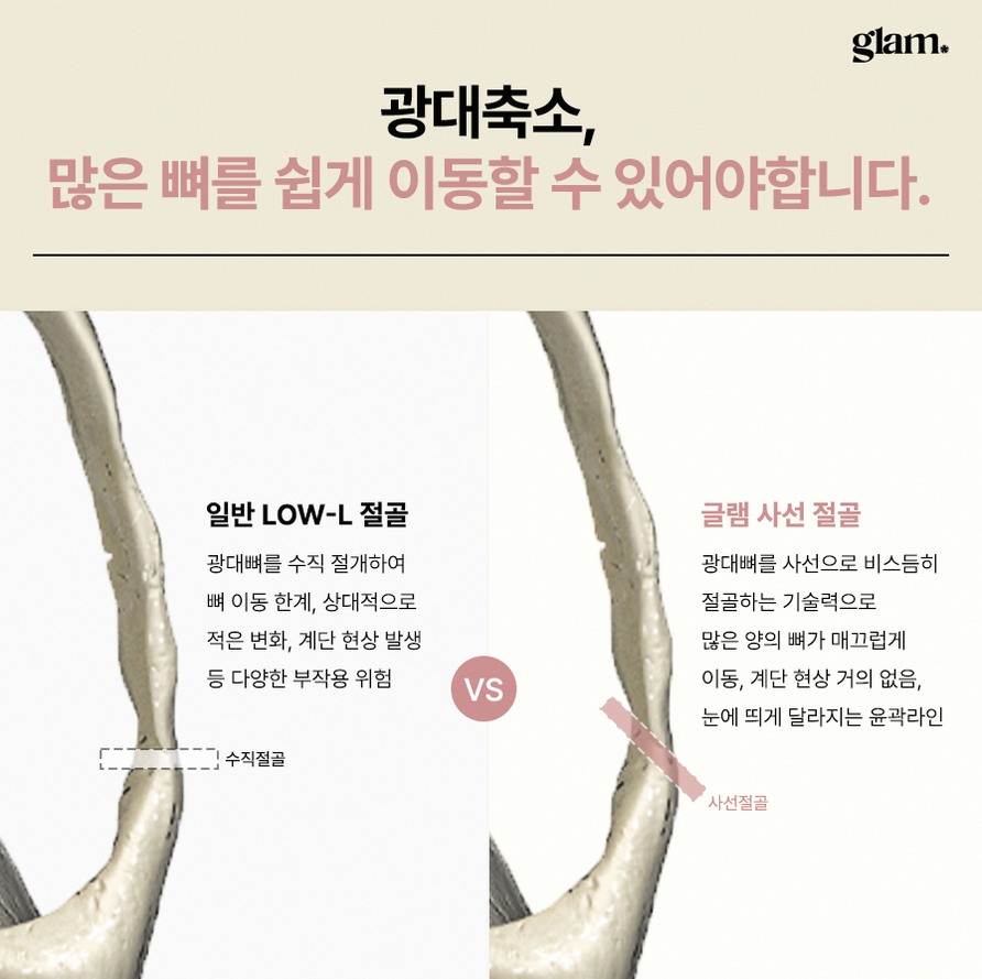 본문 내용을 보조하는 이미지