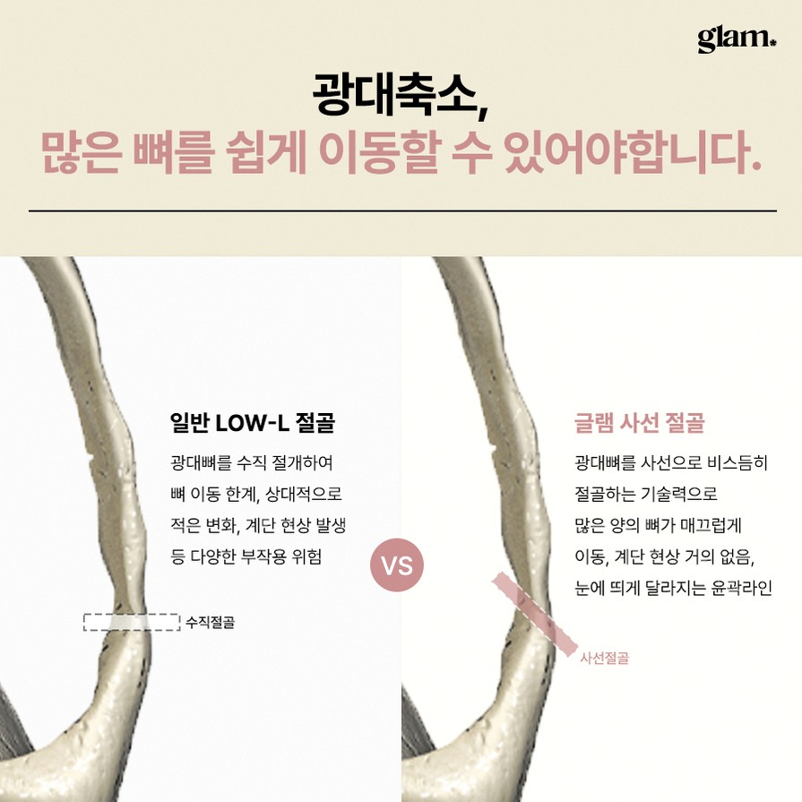 본문 내용을 보조하는 이미지