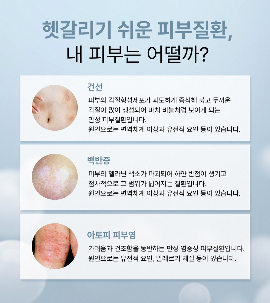 본문 내용을 보조하는 이미지