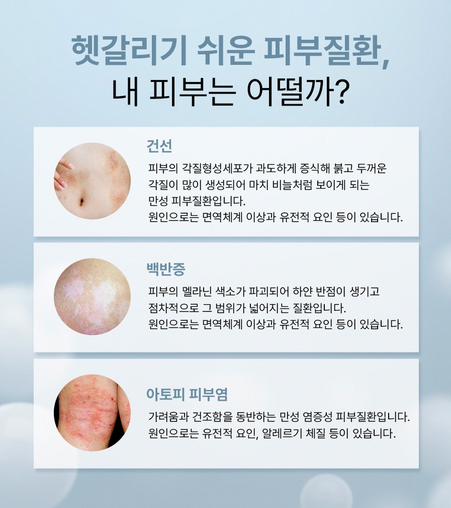 본문 내용을 보조하는 이미지