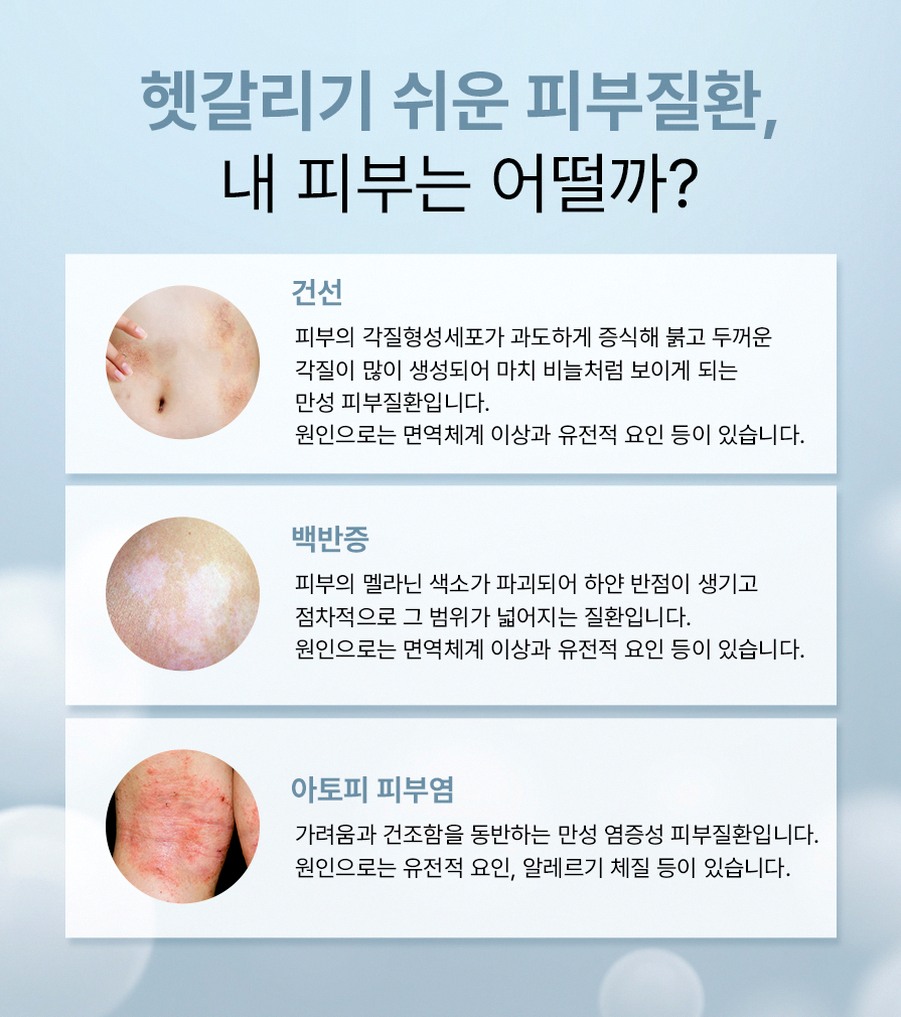 본문 내용을 보조하는 이미지