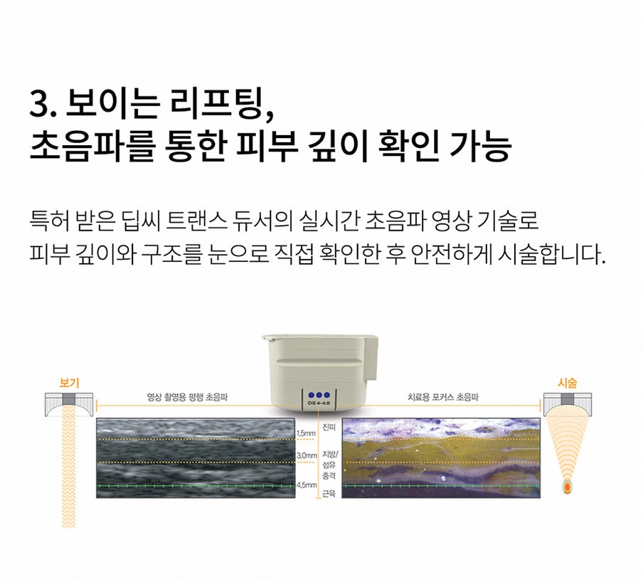 본문 내용을 보조하는 이미지