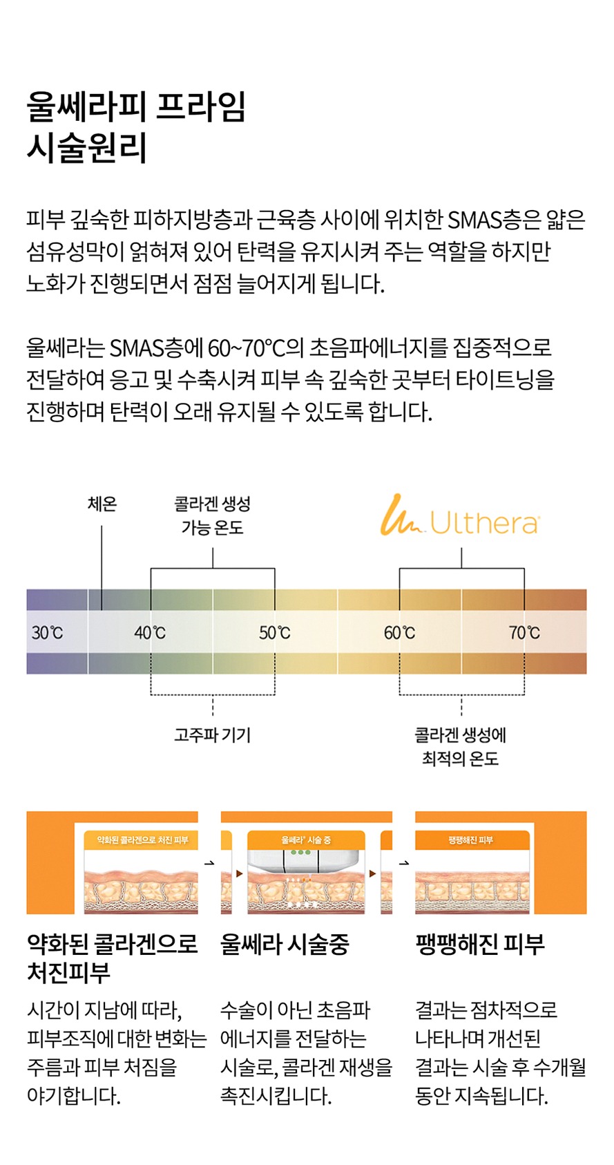 본문 내용을 보조하는 이미지