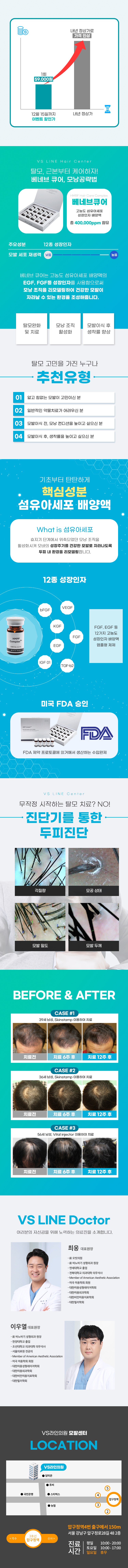 VS라인 클리닉 상담 신청 안내